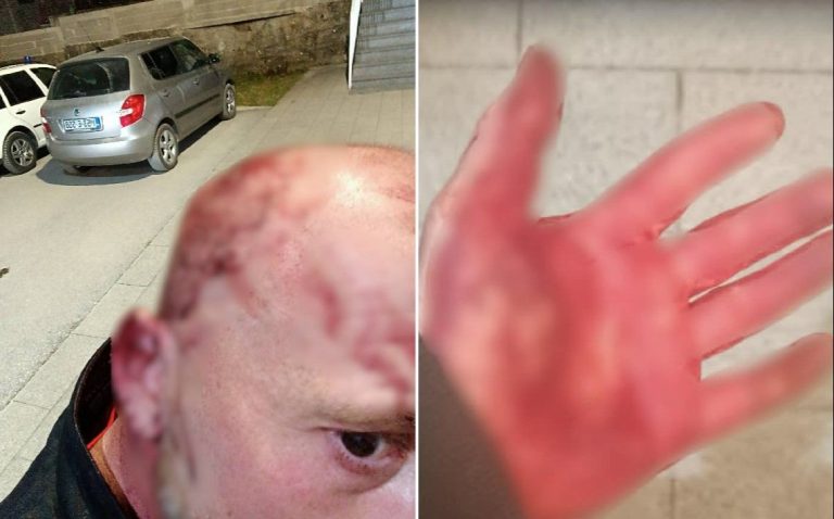 Nacionalisti divljaju u Stocu: Bivši igrač Sarajeva Edin Pehlić i njegov kolega brutalno napadnuti